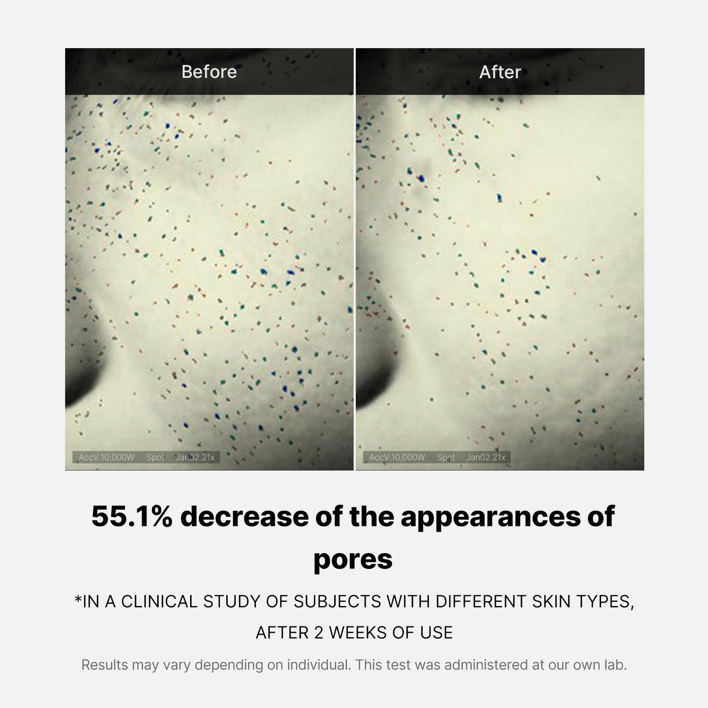 zero-pore-one-day-cream-y5 04_3616addc-f184-4deb-a5d7-e3a782e4713d.jpg