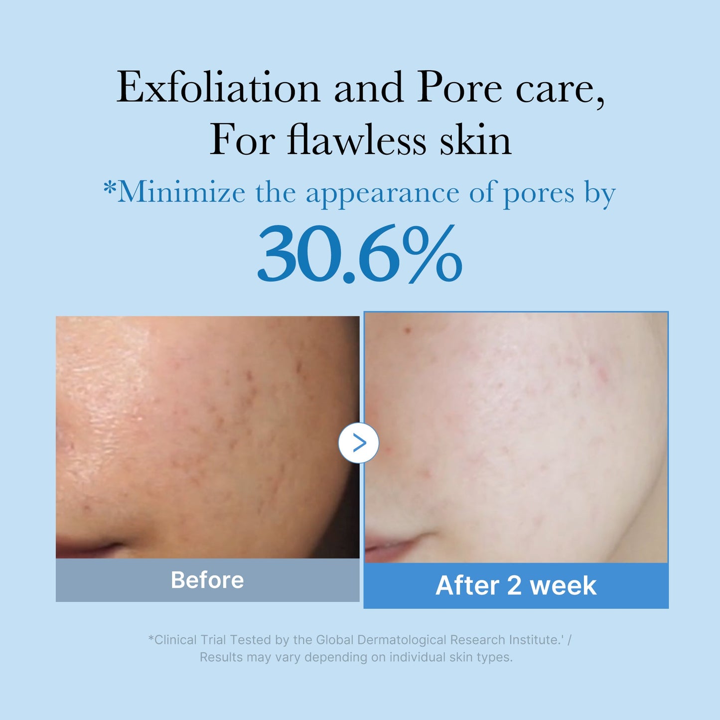 zero-pore-toner-e5 01_d6480b4e-3c08-4954-994a-ed5212c1839c.jpg