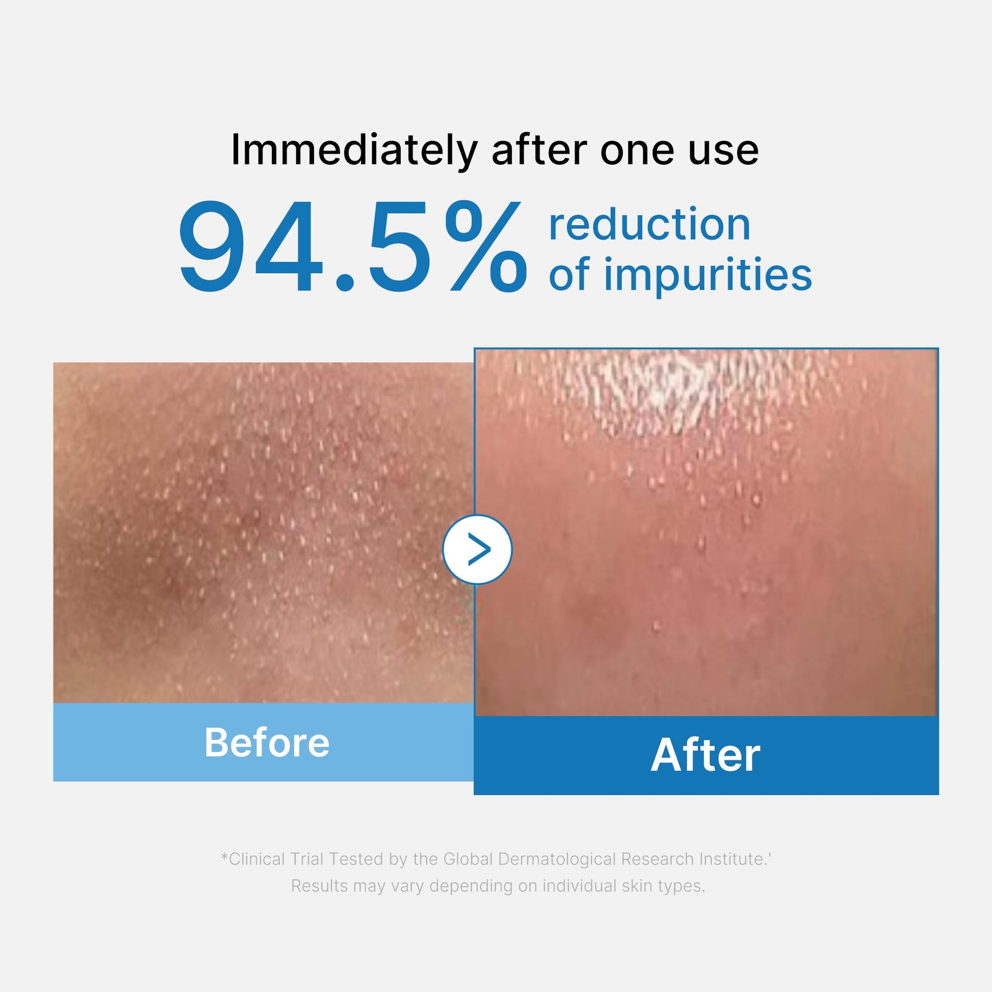 zero-pore-blackhead-deep-cleansing-oil-q1 01_eed557ec-5857-46a2-8b17-dbd67c692dcb.jpg