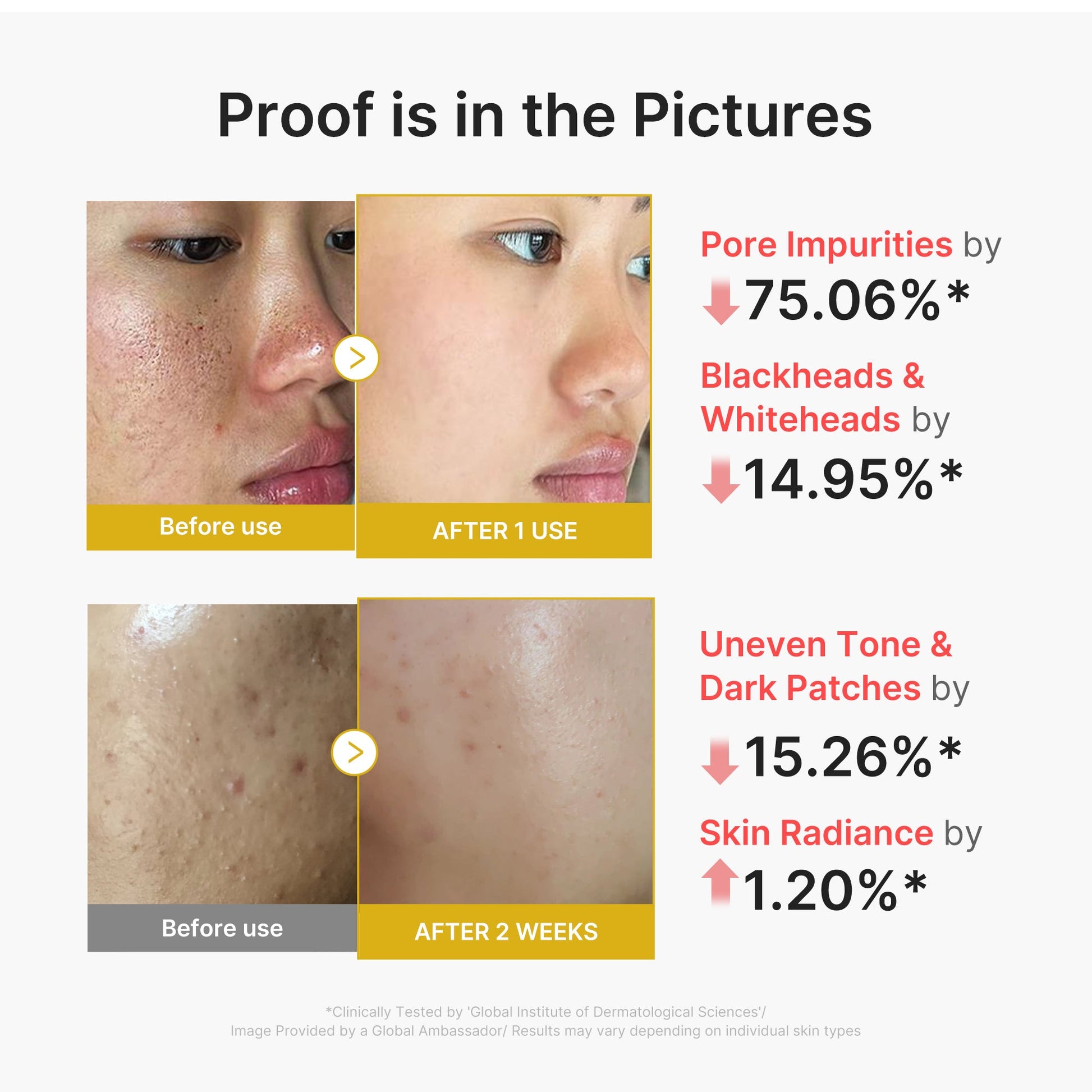 kojic-acid-turmeric-peel-shot-e7 02_45fe66d3-b3f6-4100-aa52-2afd7eded417.jpg