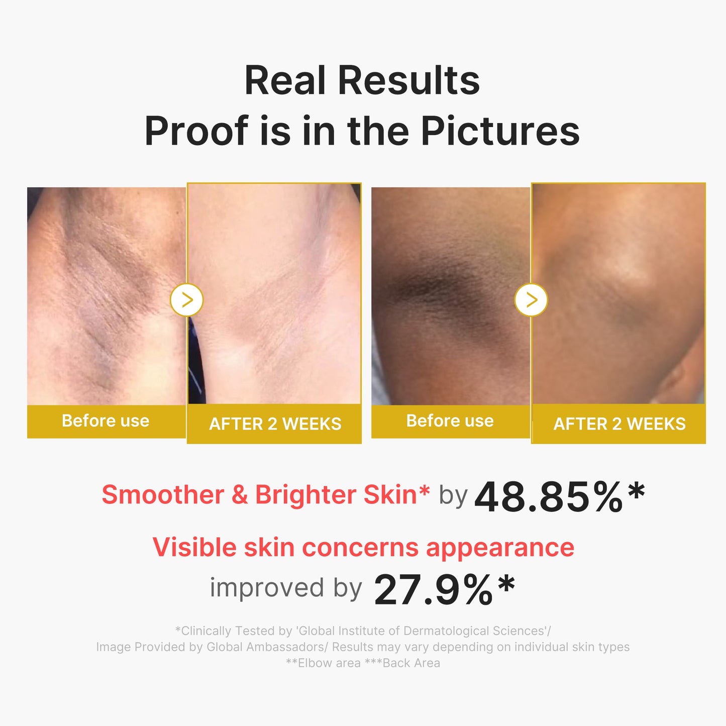 kojic-acid-turmeric-body-peel-shot-c7 02_72880cfc-382b-440b-8152-7e3dce87da2a.jpg
