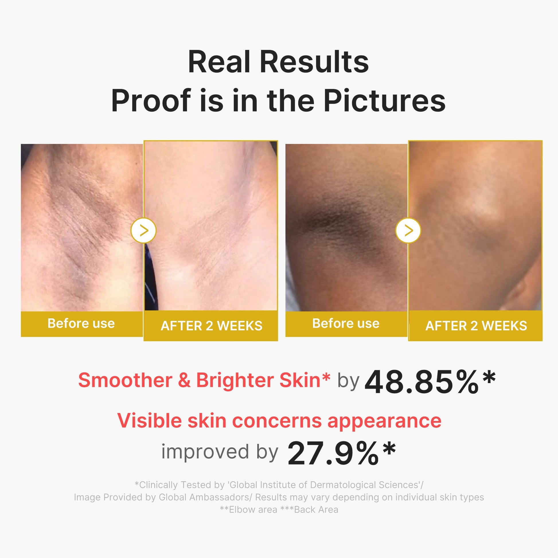 kojic-acid-turmeric-body-peel-shot-c7 02_72880cfc-382b-440b-8152-7e3dce87da2a.jpg