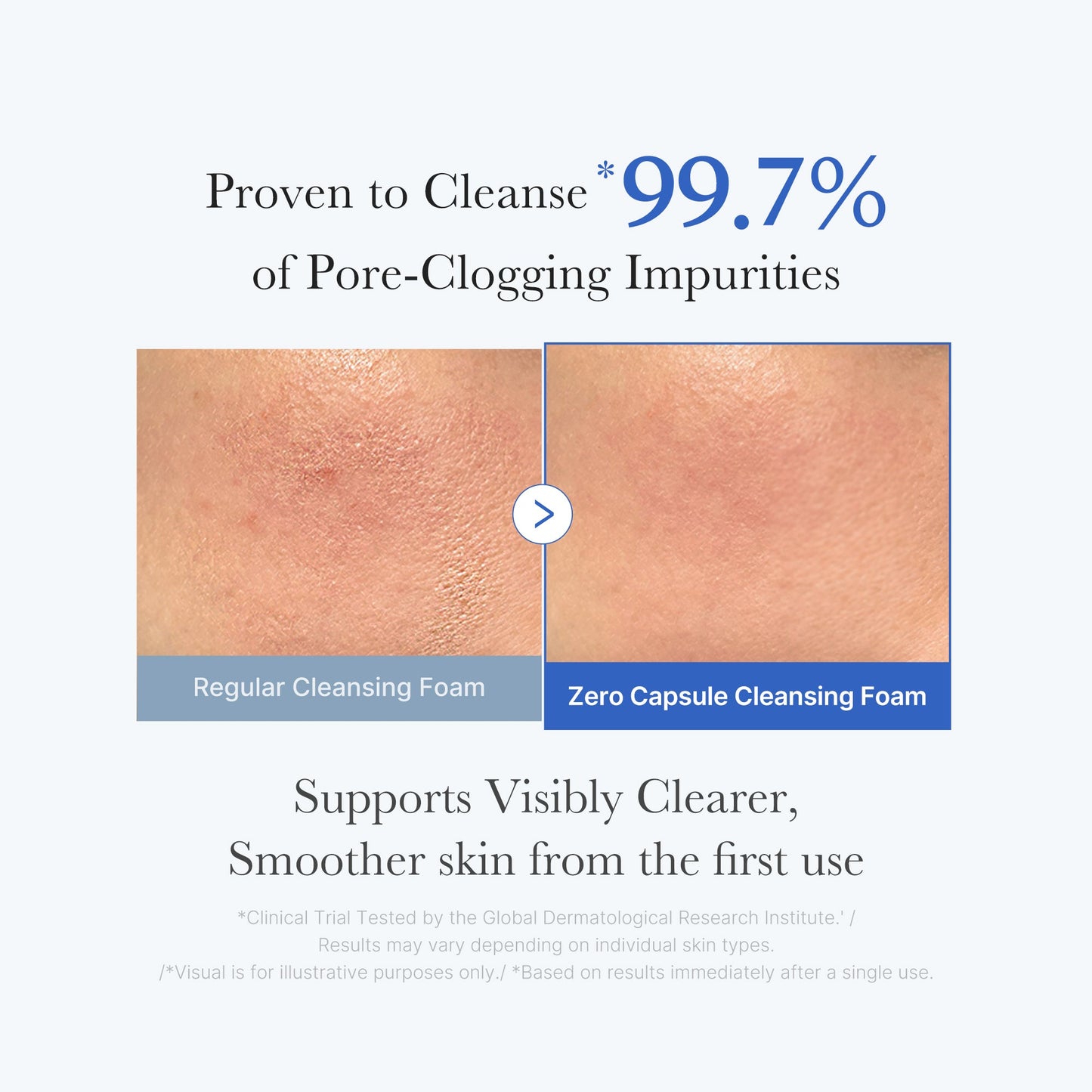 zero-pore-capsule-cleansing-foam-e6 02_c1fb9dfb-86c5-4038-8ff8-490d1006276c.jpg