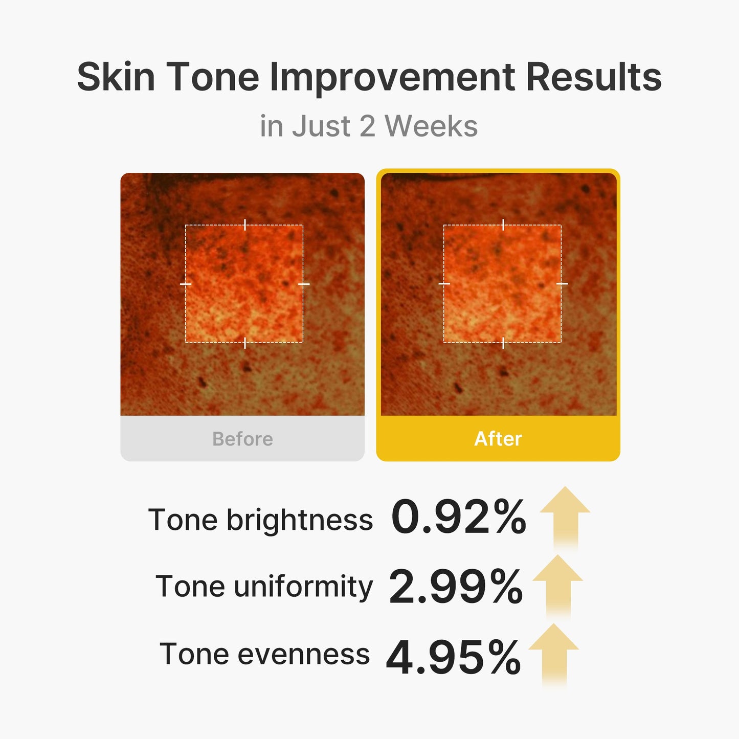 kojic-acid-turmeric-vita-capsule-cream-h3 03_2b626701-fc6c-4702-9e96-a2157a4f7f9d.jpg