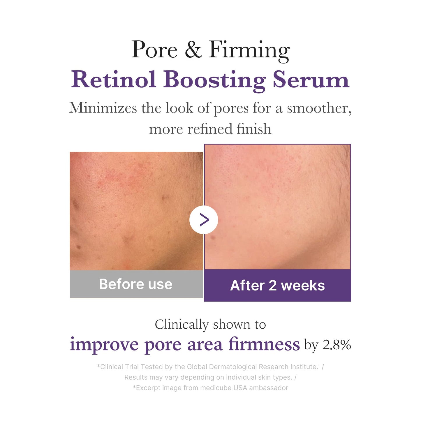 retinol-nmn-boosting-serum-k2 03_3510e7a5-5633-4a18-81ea-1389593bd517.jpg
