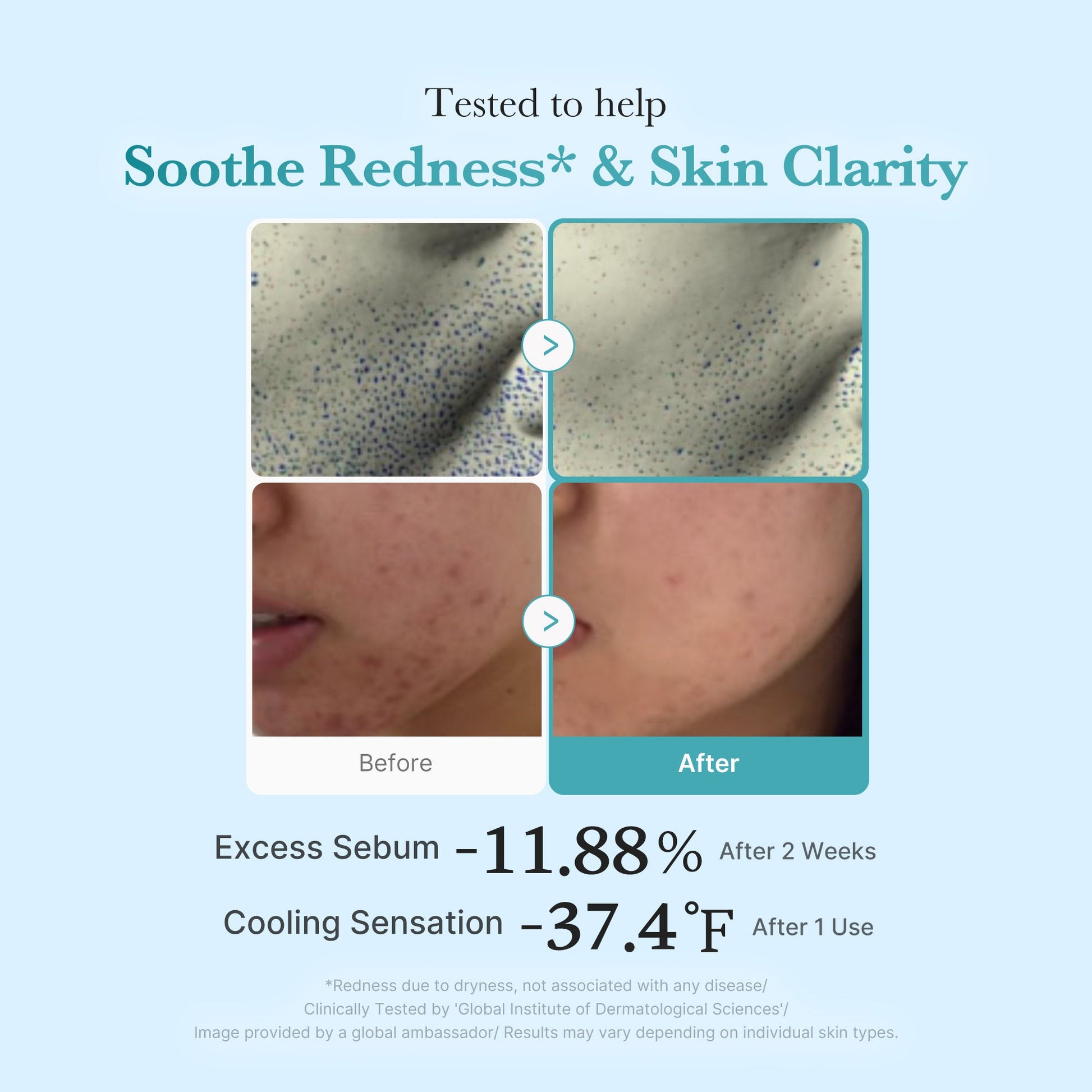 azelaic-acid-niacinamide-clarifying-toner-s5 03_9339e653-97a3-4b81-8763-9632be2263bf.jpg