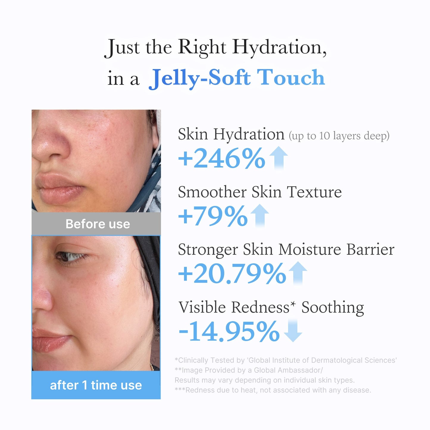 hyaluronic-ceramide-moisturizing-jelly-cream-o5 03_c39d66cc-0839-4e48-ab4a-d32143d06b1c.jpg