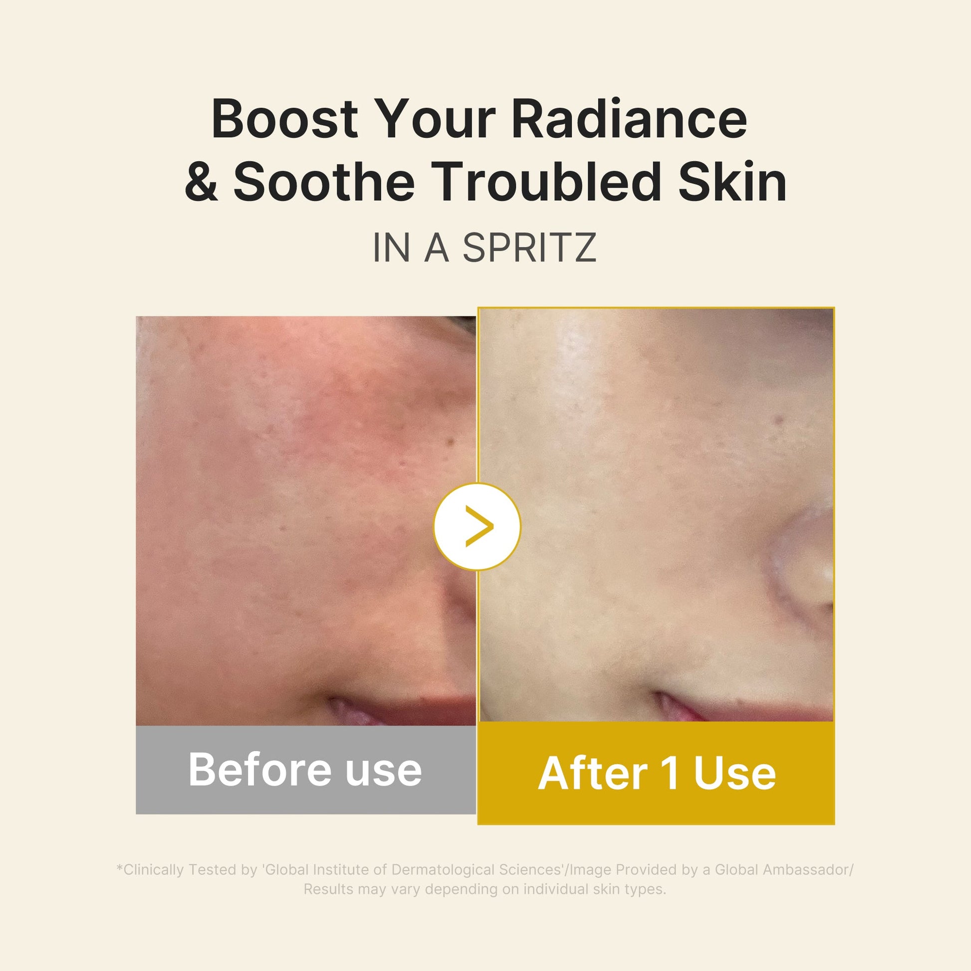 kojic-acid-turmeric-vitamin-gold-jelly-mist-serum-g1 03_dc9cd19e-4e57-49d3-9b66-c7762e8a63f1.jpg