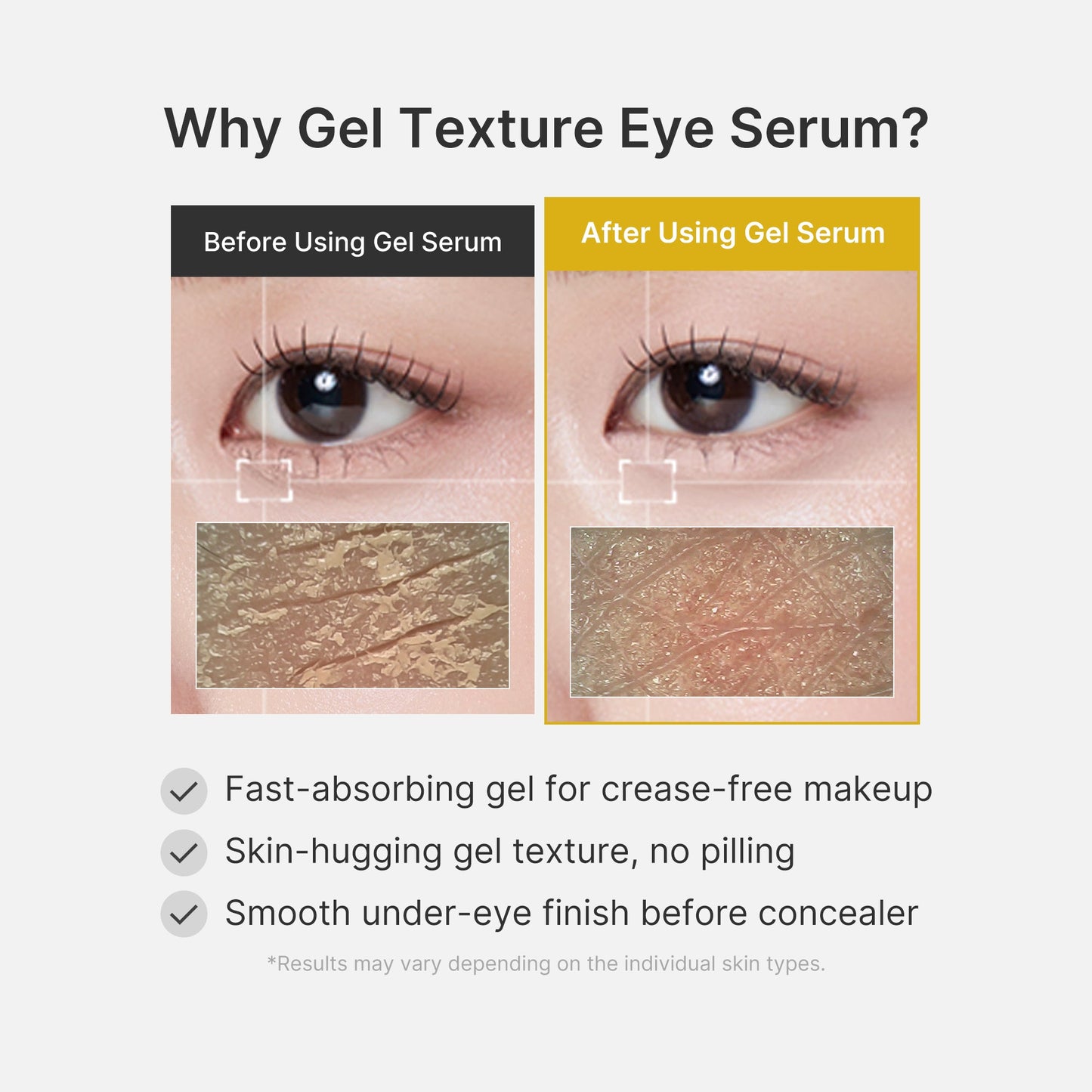 kojic-acid-tumeric-eye-gel-serum-r0 04_0487ef36-49f4-4294-8049-bb55118b05fe.jpg