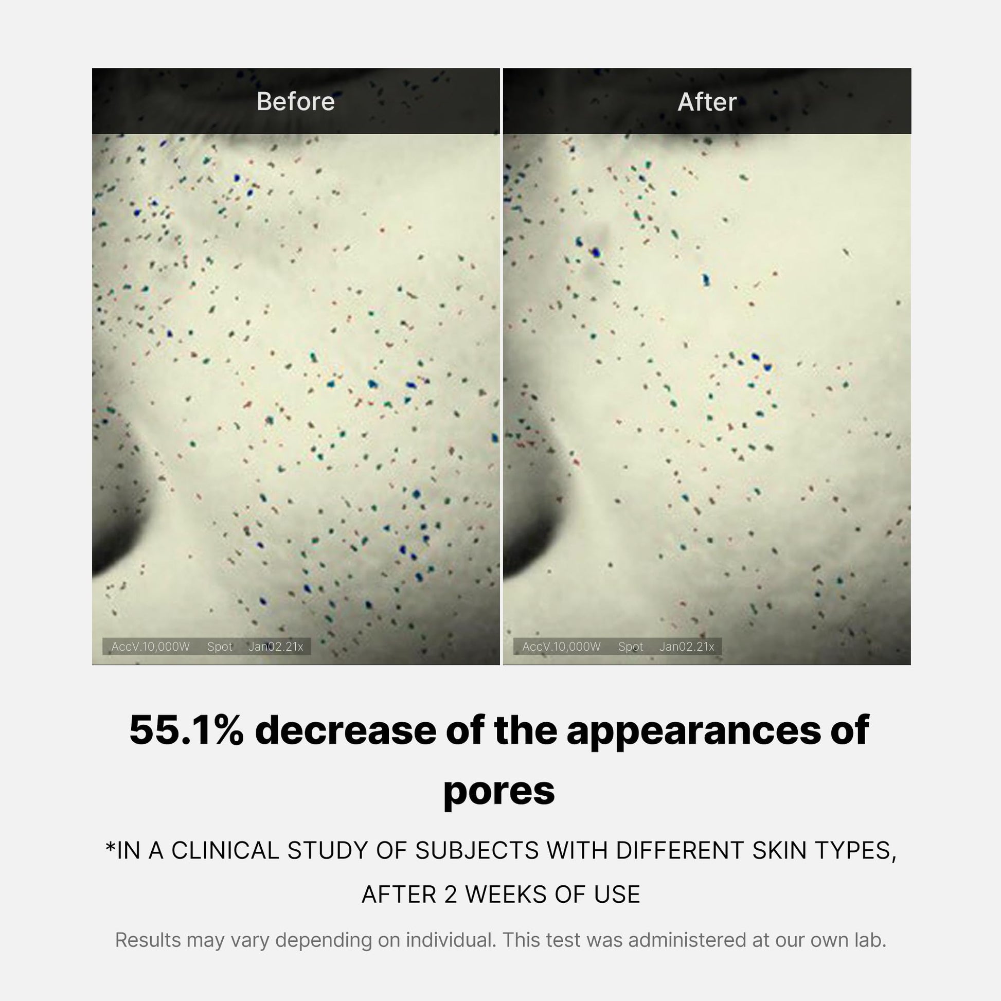 zero-pore-one-day-cream-y5 04_3616addc-f184-4deb-a5d7-e3a782e4713d.jpg