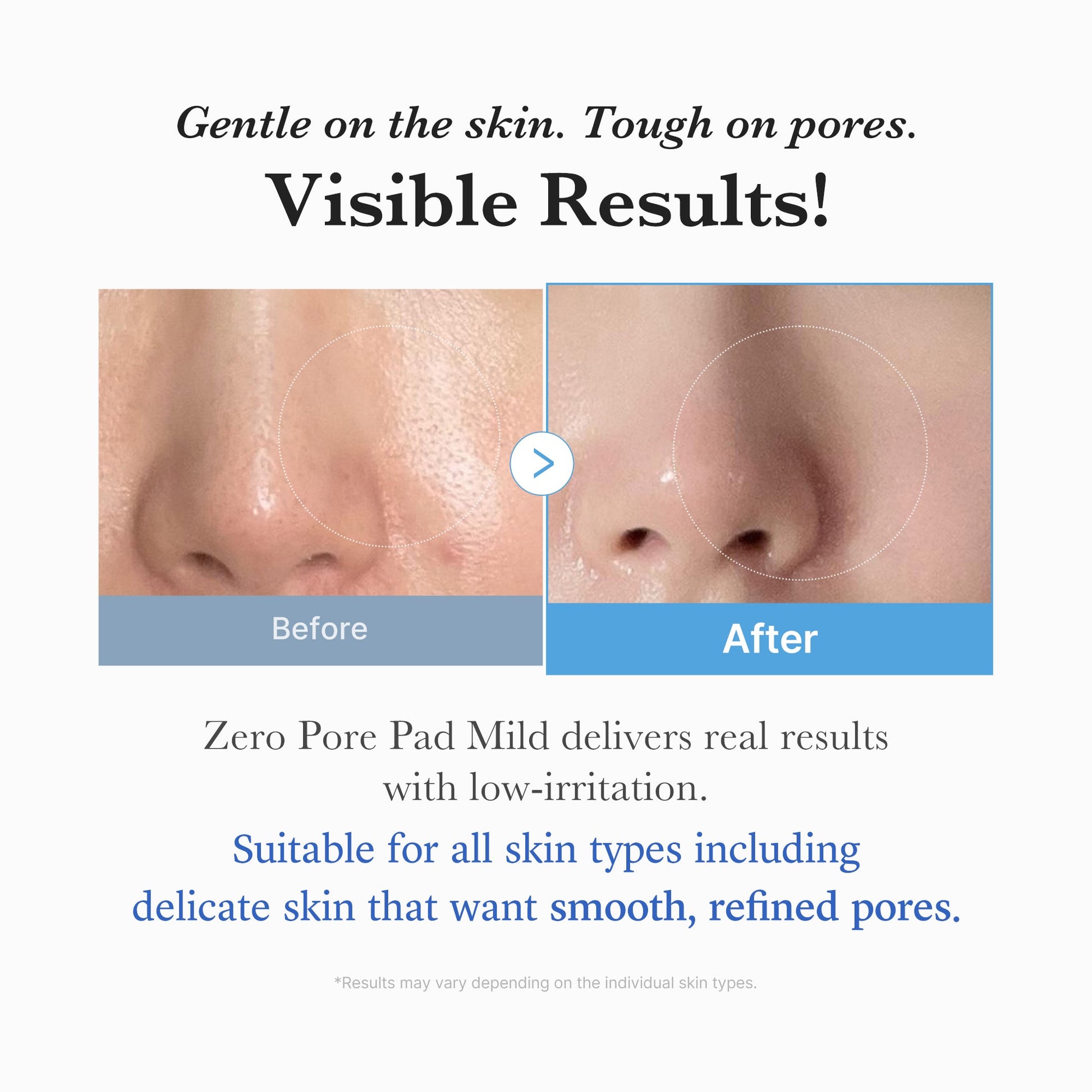 zero-pore-madecassoside-pads-mild-g9 04_6357f9f9-483b-4891-82c6-a58d336e62c8.jpg