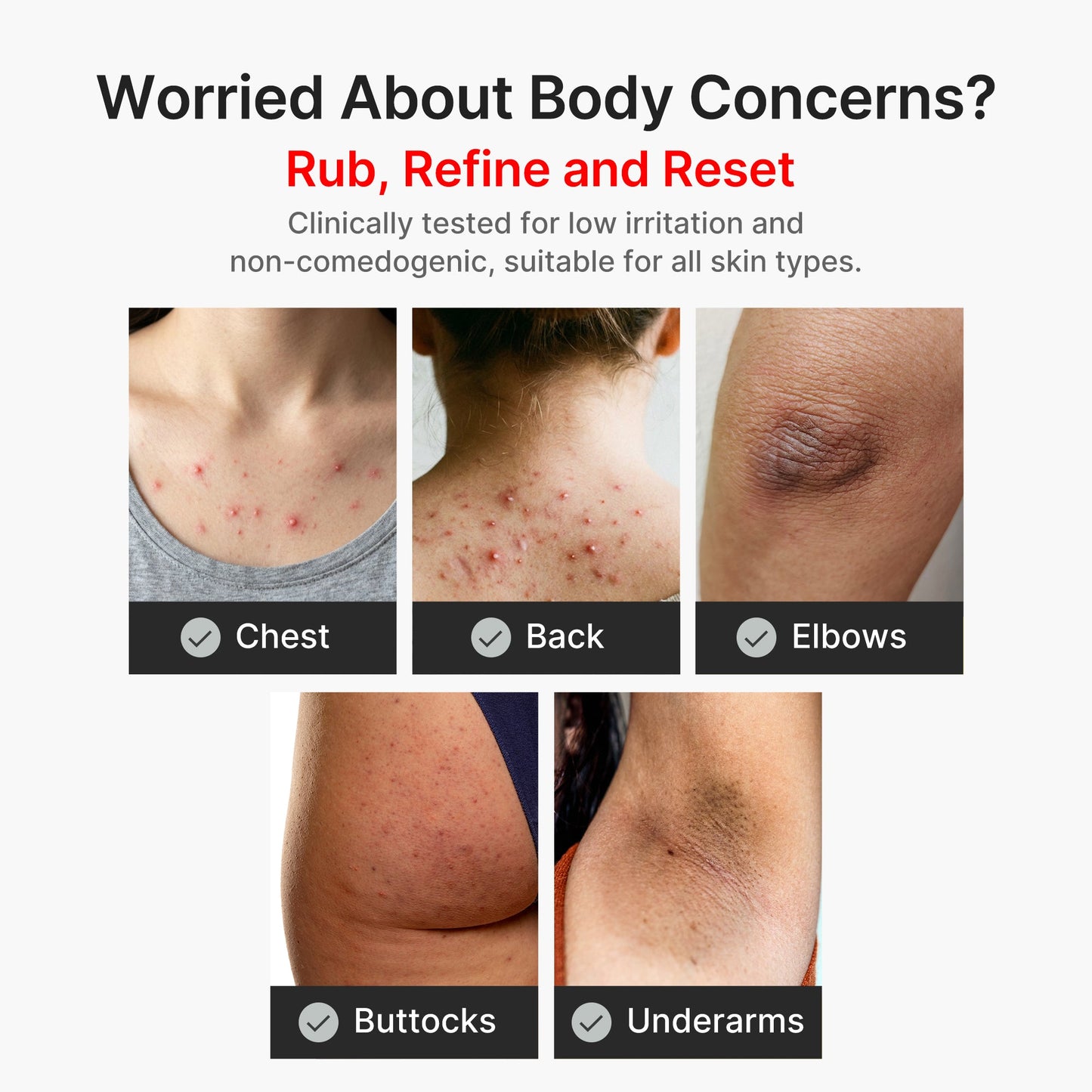kojic-acid-turmeric-body-peel-shot-c7 04_8a7237f2-3ebf-401e-bd85-54841aeb3efc.jpg