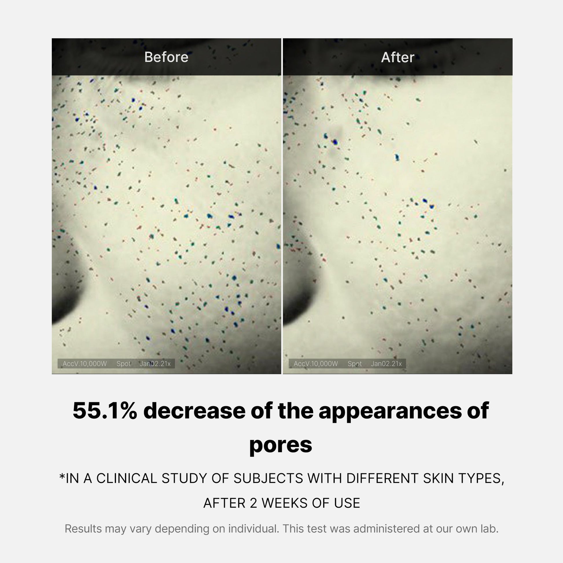 pore-care-duo-c6 05_12ddab8a-64be-4612-8ee1-27e5ec701921.jpg