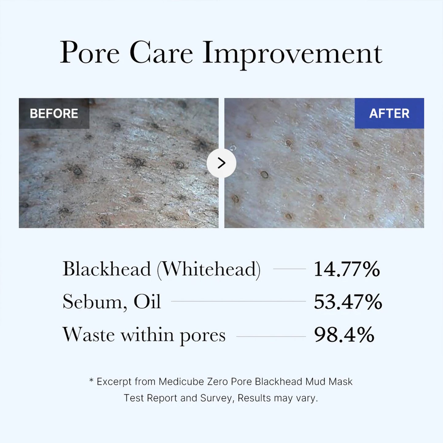 zero-pore-blackhead-mud-mask-i6 05_9362a158-c2b3-4525-acc0-631a2cfdea47.jpg
