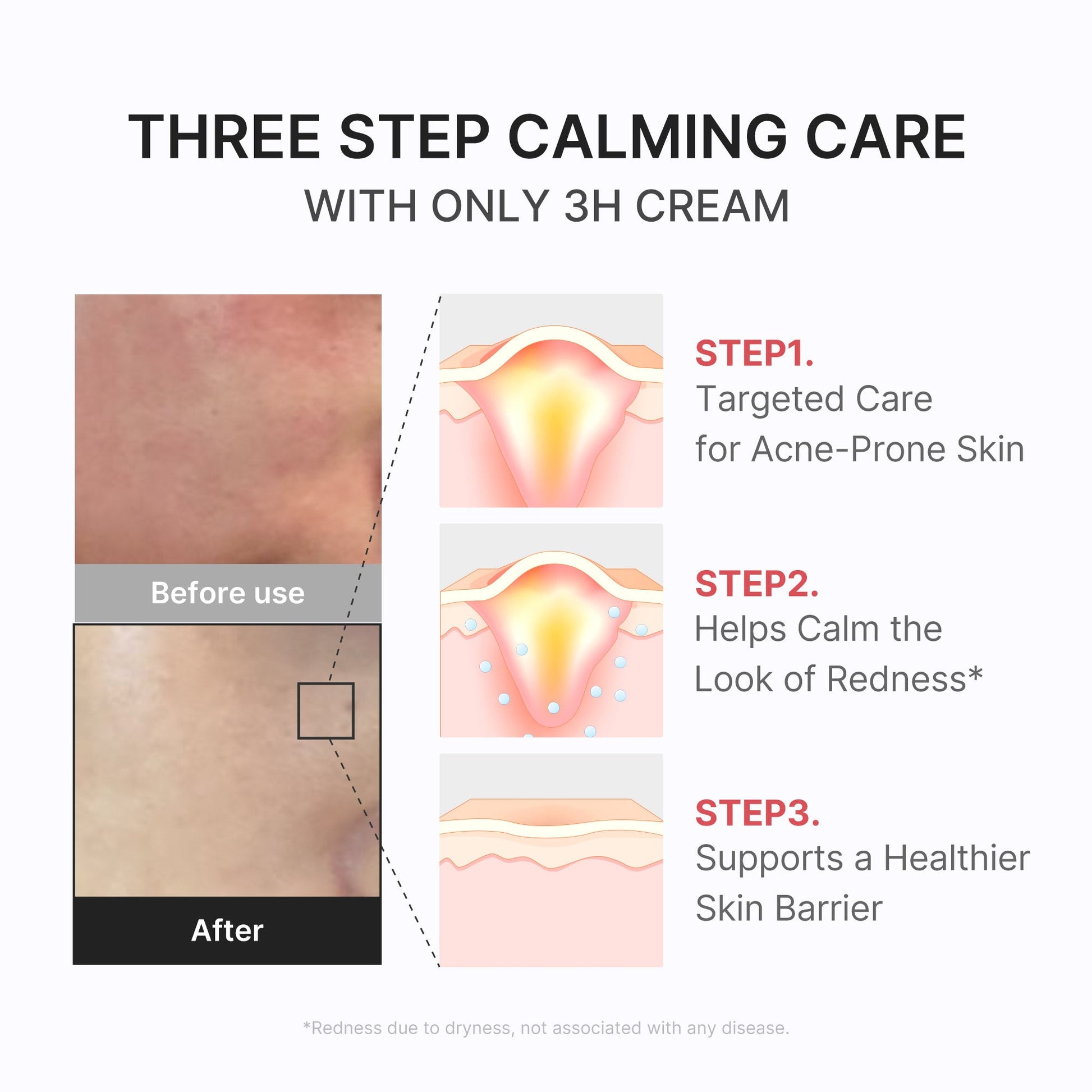 3h-daily-relief-cream-b3 3H_04.jpg