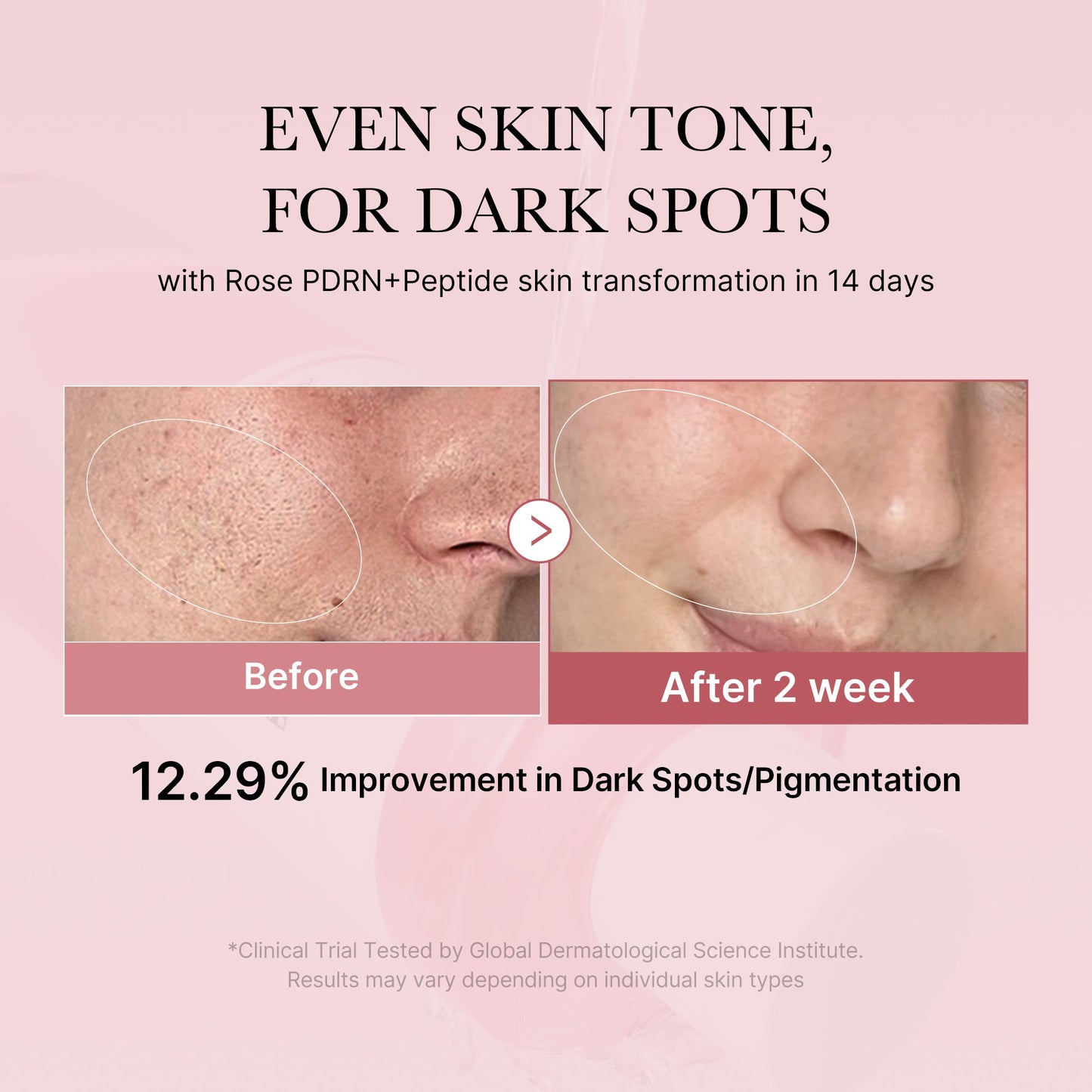 pdrn-pink-peptide-toner-a6 PDRN_01_308c518e-5ac6-4e54-99bd-eabc8796739b.jpg