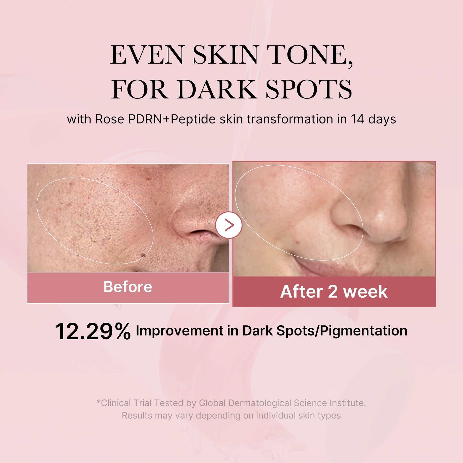 pdrn-pink-peptide-toner-a6 PDRN_01_308c518e-5ac6-4e54-99bd-eabc8796739b.jpg