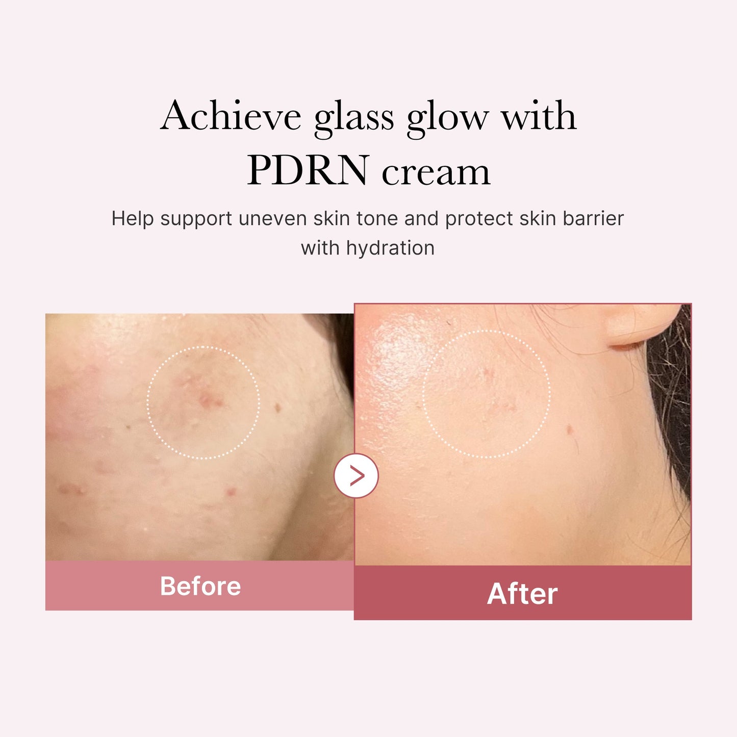 pdrn-pink-peptide-cream-y0 PDRN_02_d7805bfe-cf43-446a-b71b-a276683f136b.jpg