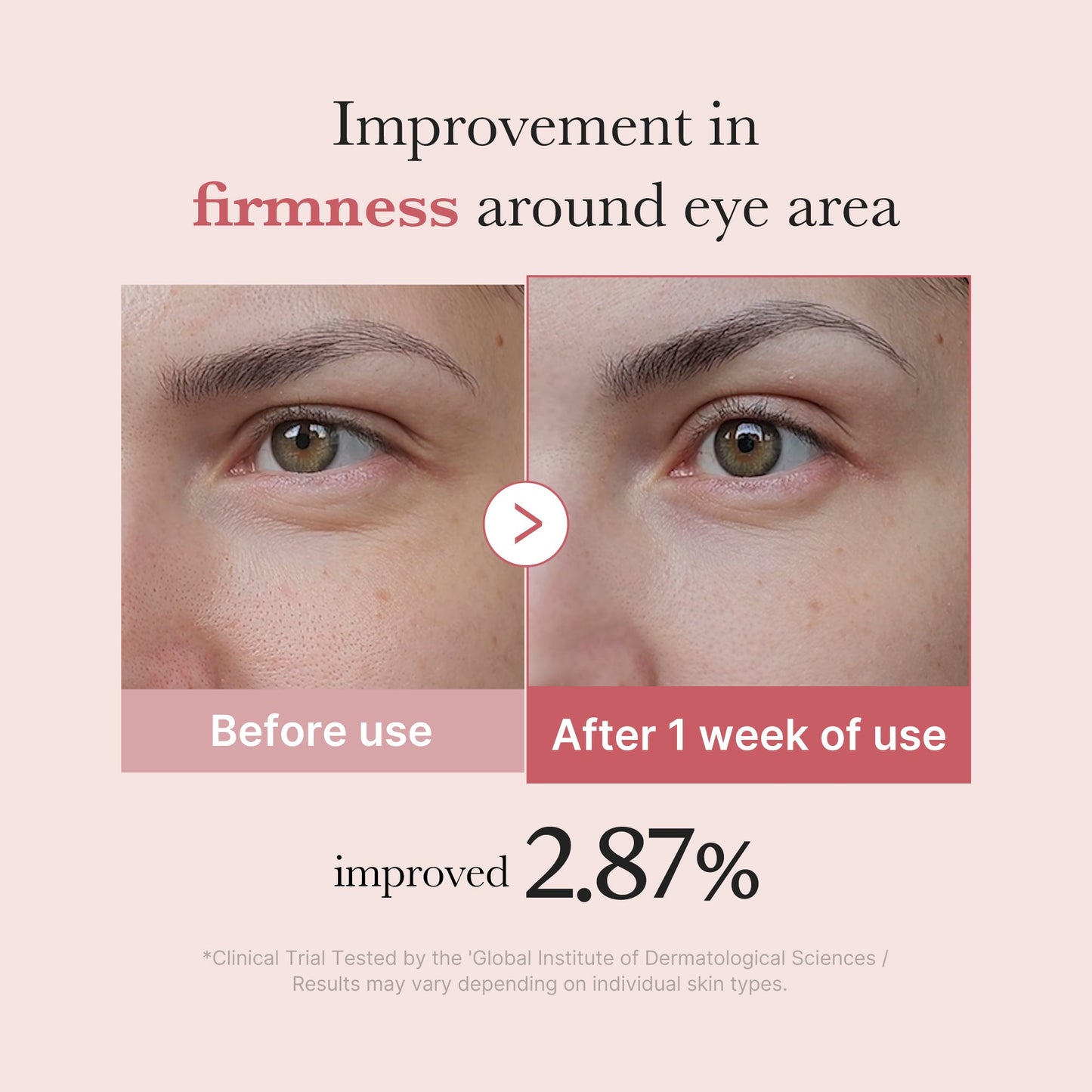 pdrn-pink-peptide-eye-cream-s9 PDRN_03_256dd753-0a2f-41b4-b3cd-bbfd3bc27018.jpg