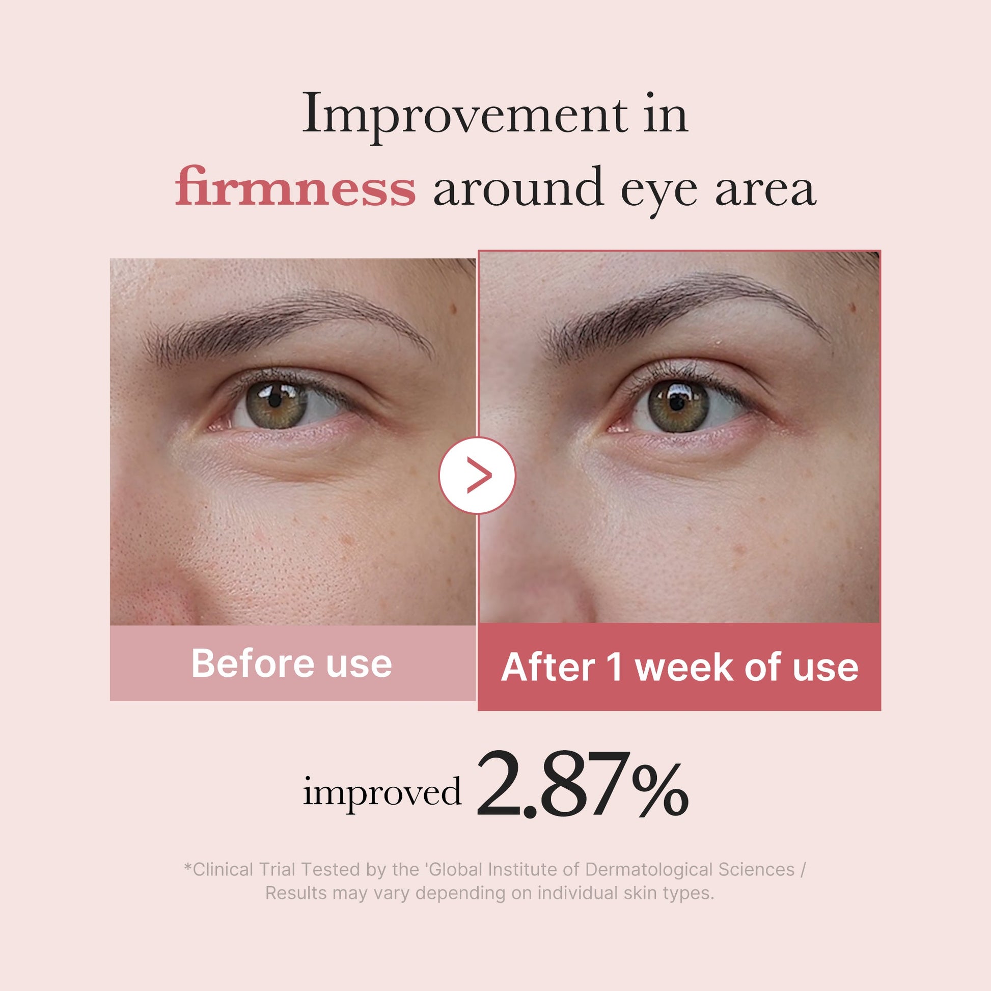 pdrn-pink-peptide-eye-cream-s9 PDRN_03_256dd753-0a2f-41b4-b3cd-bbfd3bc27018.jpg