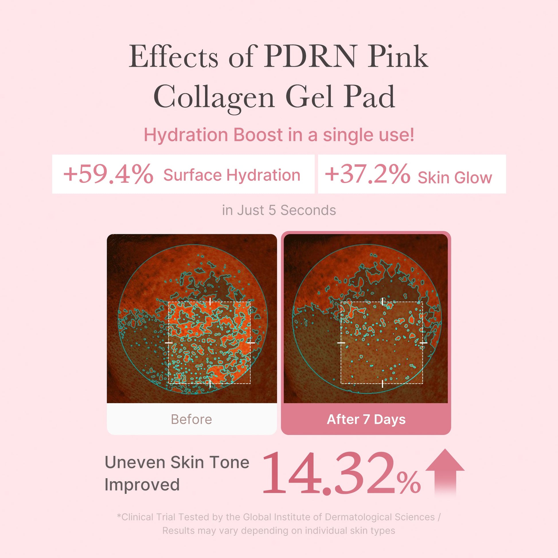 pdrn-pink-collagen-gel-toner-pad-r3 PDRN_04_f9a16a56-8d9e-4c47-a635-ed34ec3ed571.jpg