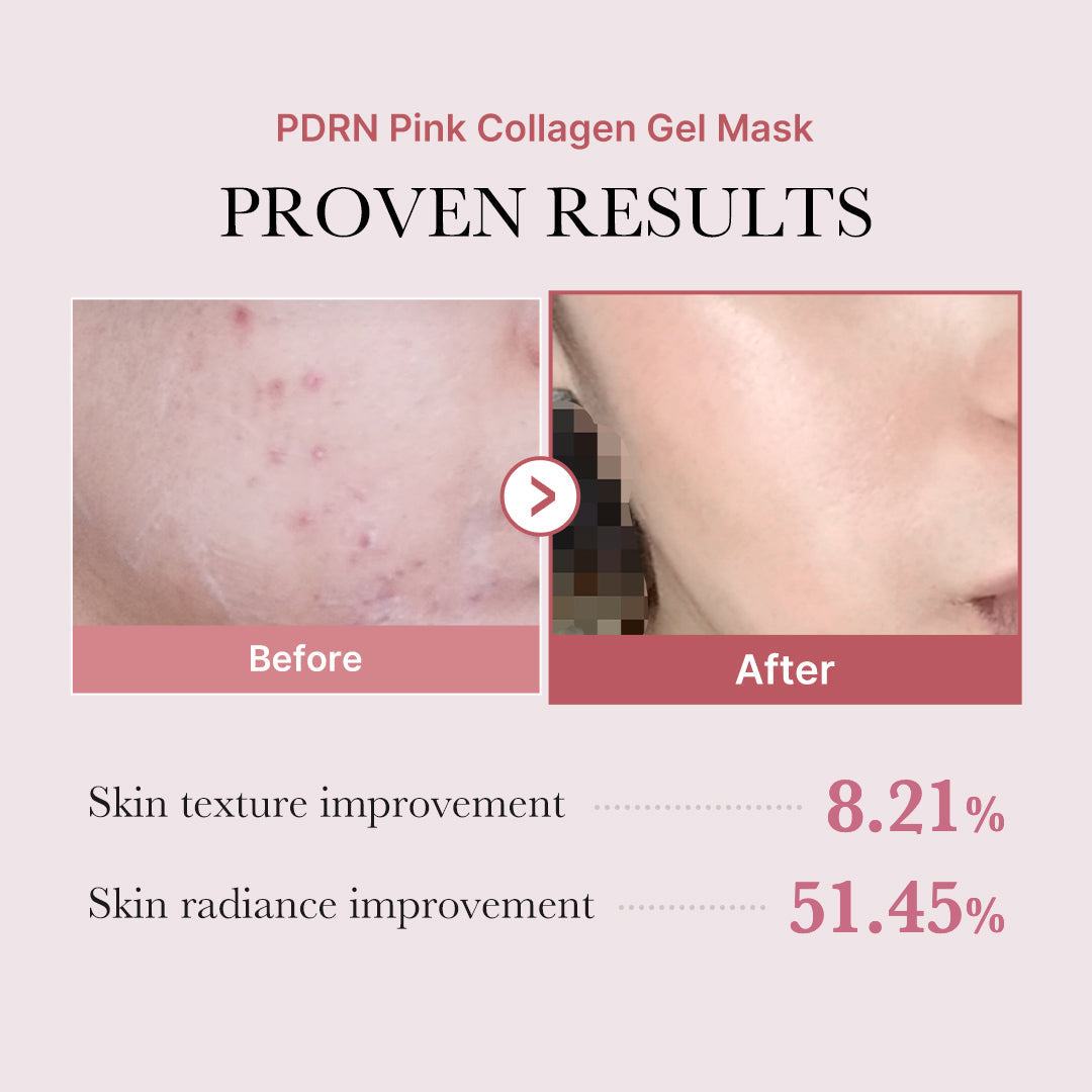 salmon-pdrn-pink-collagen-jelly-gel-mask-a3 PDRN_12.jpg